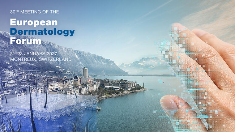 edf30 teaserbild linkedin mittext